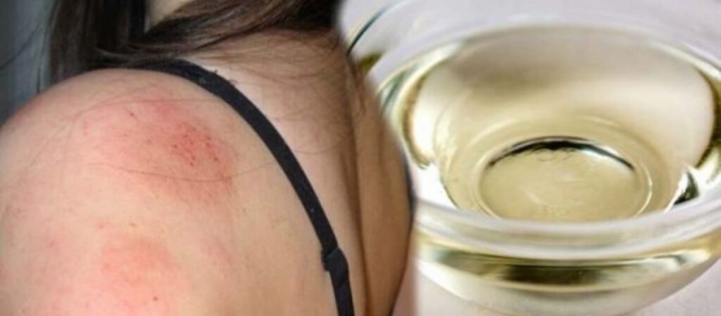 Dầu dừa có tốt cho da không? Công dụng và cách dùng dầu dừa hiệu quả