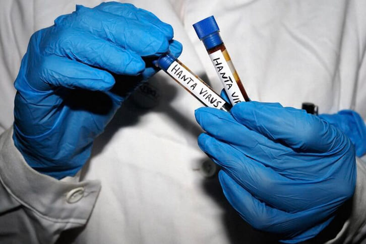 Mục tiêu hỗ trợ phát triển vaccine và phương pháp điều trị