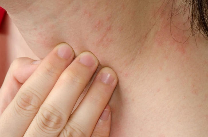 Vì sao suy thận gây ngứa da?
