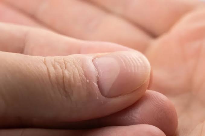 Các yếu tố ảnh hưởng đến móng tay