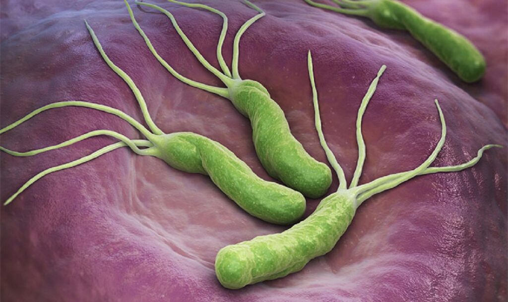 Nhiễm vi khuẩn Helicobacter pylori (HP)